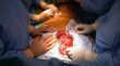 Tumor�-gigant de 10 kilograme, operat� la Cluj