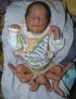 Un copil s-a n�scut cu �ase picioare. Medicii pakistanezi �ncearc� s�-i salveze via�a