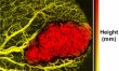 Descoperirea care va revolu�iona medicina din �ntreaga lume. Cancerul va putea fi depistat �nainte de a se forma tumora